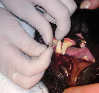 удаление путридных масс из канала зуба