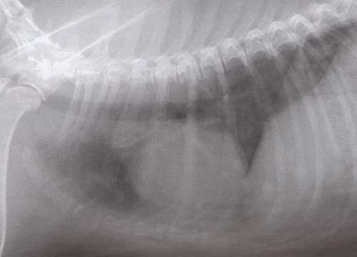 Рис. 5. Рентгеновский снимок грудной клетки в боковой проекции. В полях легких видны множественные очаги, возможно, метастазы