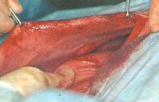 Рисунок 8. Вид операционного поля во время проведения инцизионной гастропексии. Сделаны надрезы длиной 5-8 см на поперечной брюшной мышце несколько каудальнее последнего ребра на правой стороне стенки брюшной полости и на серозо-мышечной оболочке желудка
